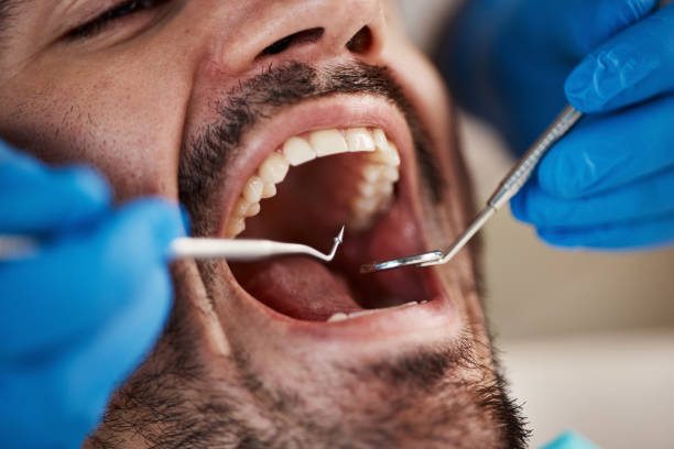 Best Chipped Tooth Repair Near Me  in Crouch Mesa, NM