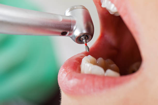 Best Root Canal Emergency Dentist  in Crouch Mesa, NM
